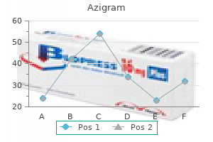 order 250 mg azigram visa