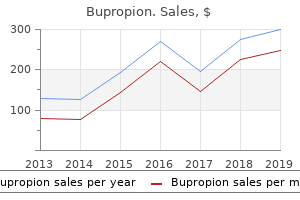 bupropion 150 mg with amex